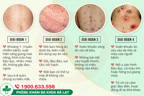 Hình ảnh minh họa